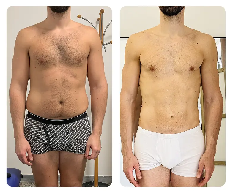 Dr. Nicola Pontrelli - Prima e dopo