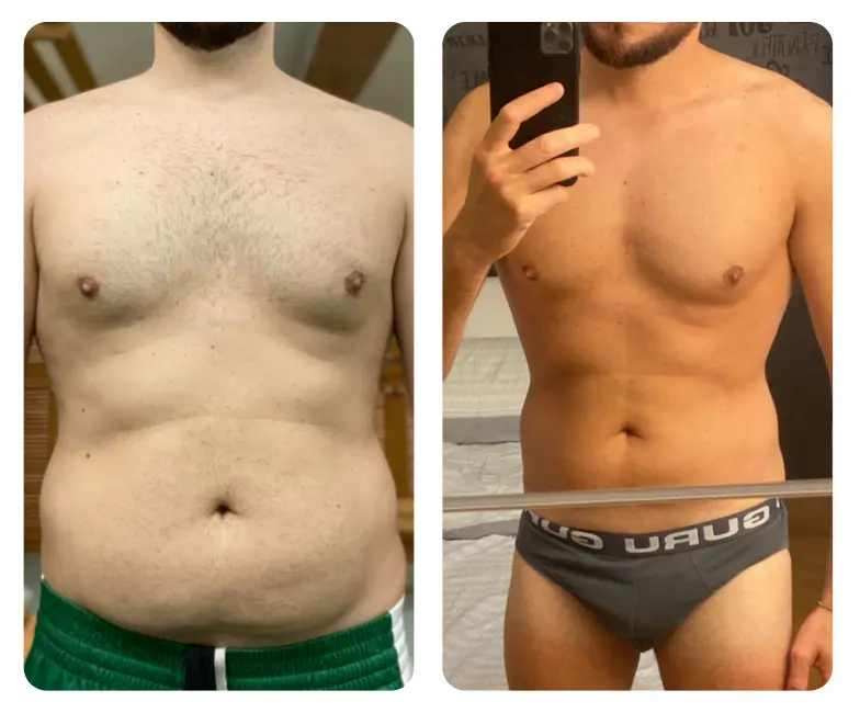 Dr. Nicola Pontrelli - Prima e dopo