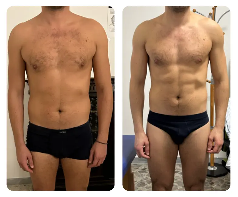 Dr. Nicola Pontrelli - Prima e dopo