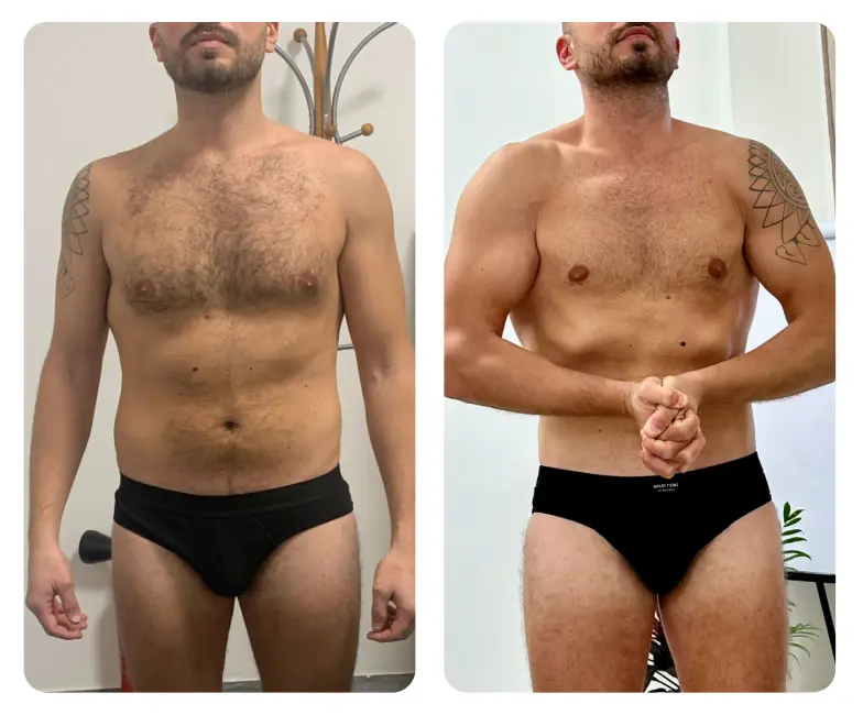 Dr. Nicola Pontrelli - Prima e dopo