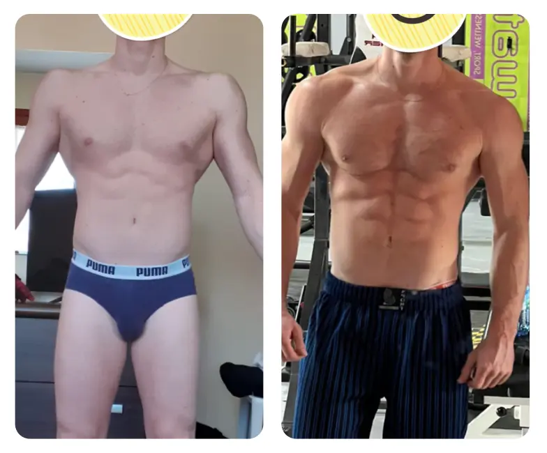 Dr. Nicola Pontrelli - Prima e dopo