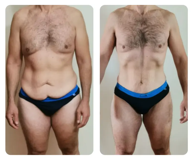 Dr. Nicola Pontrelli - Prima e dopo