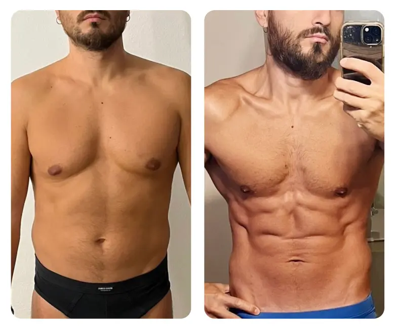 Dr. Nicola Pontrelli - Prima e dopo